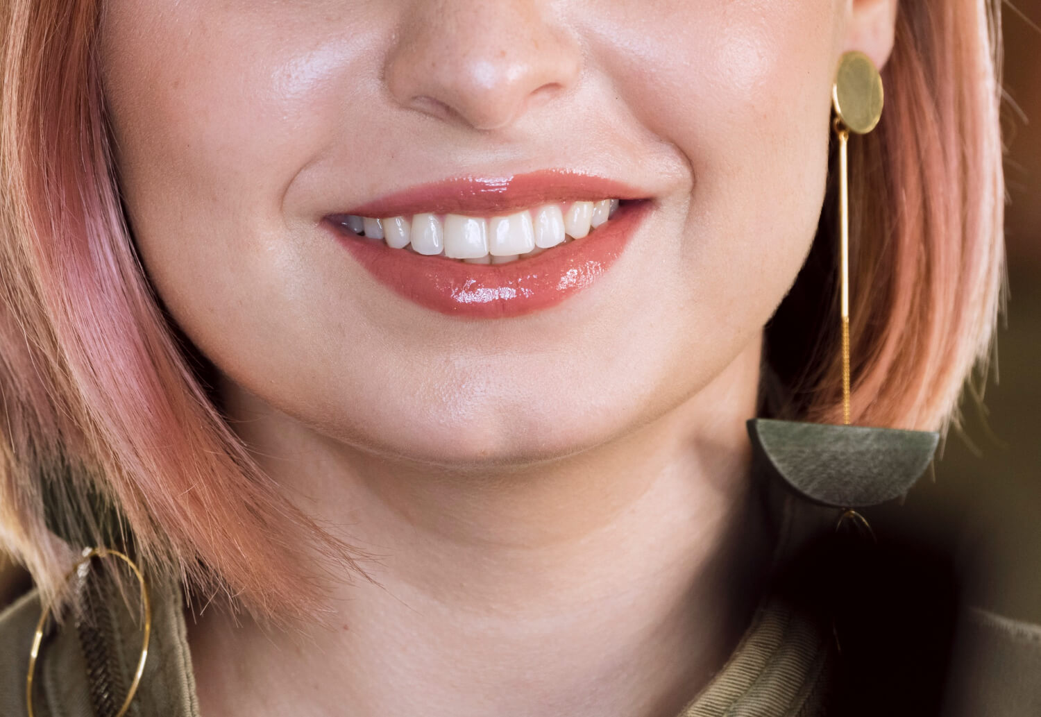 Lente de Contato Dental Juiz de Fora